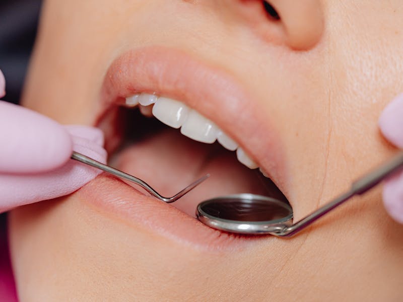Needleless Anesthesia